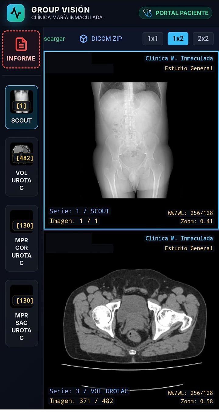 Visor DICOM de Clínica María Inmaculada en el celular